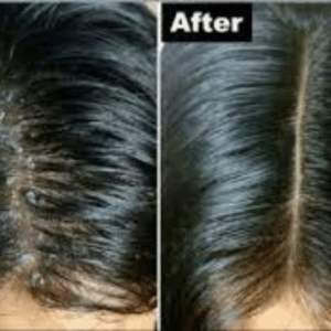 Menthol – انتعاش بيوصل للجذور: ينظّف فروة الرأس، يحفّز البصيلات، ويدّي شعور بالنضارة والانتعاش من أول غسلة.